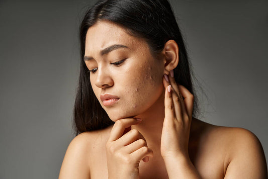 After Radiation: What's Normal for Your Skin (And What's Not)