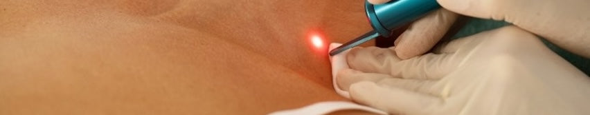 The Smarter Post-Laser Treatment Cream: Why Natural, Bioactive Ingredients Matter for Recovery